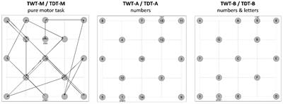 Skillful and strategic navigation in soccer – a motor-cognitive dual-task approach for the evaluation of a dribbling task under different cognitive load conditions